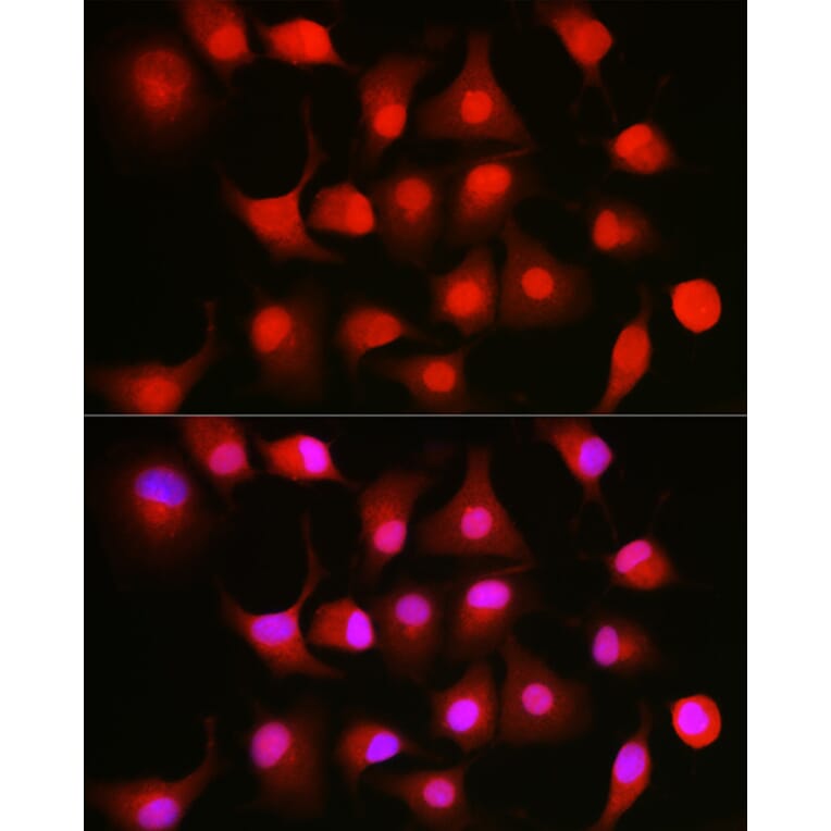 Immunofluorescence - Anti-NFkB p105/p50 Antibody (A15324) - Antibodies.com