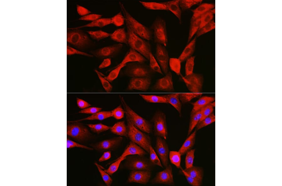 Immunofluorescence - Anti-NFkB p105/p50 Antibody (A15324) - Antibodies.com