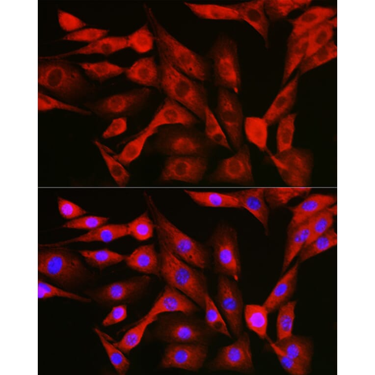 Immunofluorescence - Anti-NFkB p105/p50 Antibody (A15324) - Antibodies.com