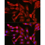 Immunofluorescence - Anti-NFkB p105/p50 Antibody (A15324) - Antibodies.com