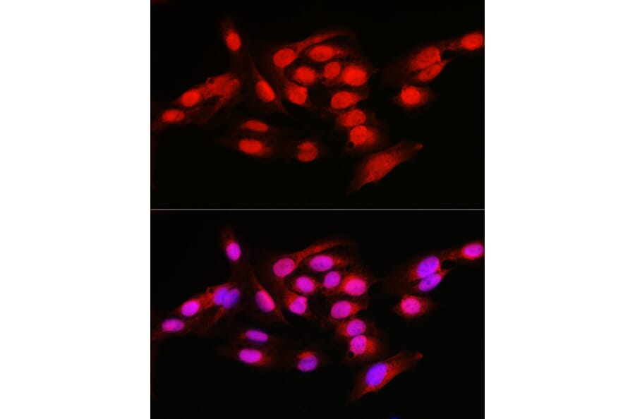 Immunofluorescence - Anti-NFkB p105/p50 Antibody (A15324) - Antibodies.com