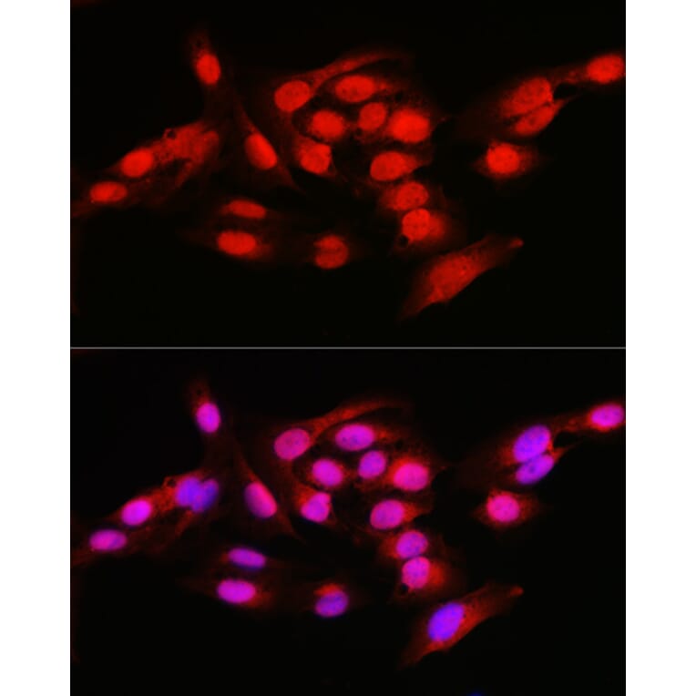 Immunofluorescence - Anti-NFkB p105/p50 Antibody (A15324) - Antibodies.com