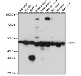 Western Blot - Anti-NFS1 Antibody (A15325) - Antibodies.com