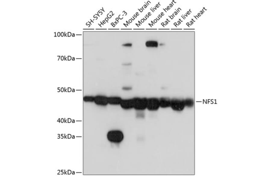 Western Blot - Anti-NFS1 Antibody (A15325) - Antibodies.com