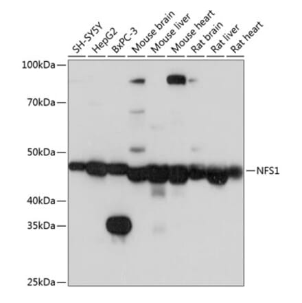 Western Blot - Anti-NFS1 Antibody (A15325) - Antibodies.com