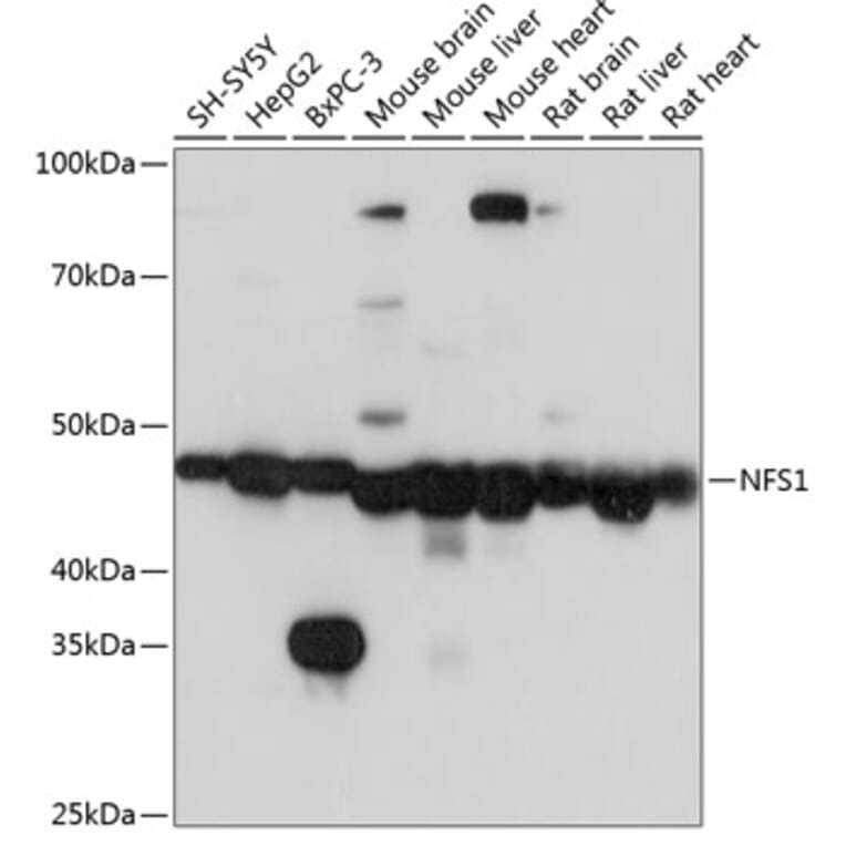 Western Blot - Anti-NFS1 Antibody (A15325) - Antibodies.com