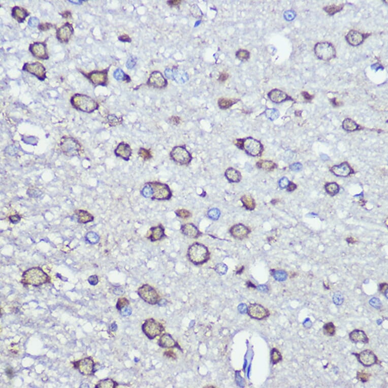 Immunohistochemistry - Anti-NFS1 Antibody (A15325) - Antibodies.com