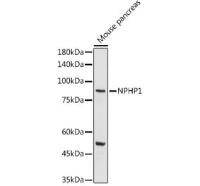 Western Blot - Anti-NPHP1 Antibody (A15326) - Antibodies.com