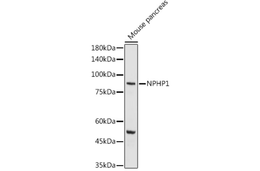 Western Blot - Anti-NPHP1 Antibody (A15326) - Antibodies.com