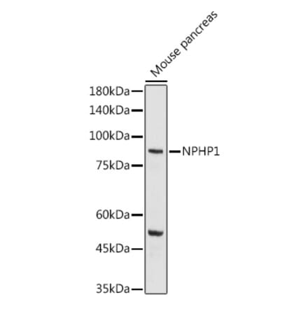 Western Blot - Anti-NPHP1 Antibody (A15326) - Antibodies.com
