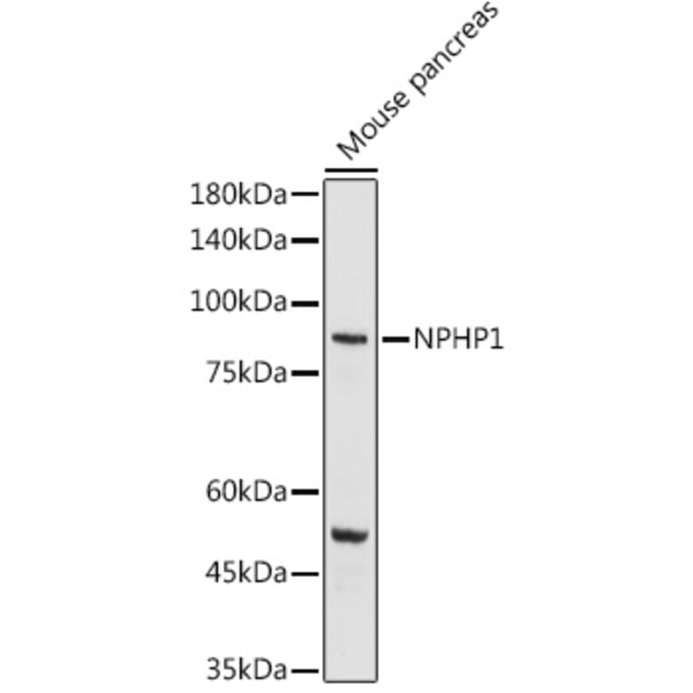 Western Blot - Anti-NPHP1 Antibody (A15326) - Antibodies.com