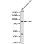 Western Blot - Anti-NPHP1 Antibody (A15326) - Antibodies.com