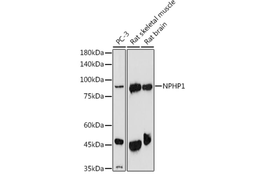 Western Blot - Anti-NPHP1 Antibody (A15326) - Antibodies.com