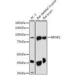 Western Blot - Anti-NPHP1 Antibody (A15326) - Antibodies.com