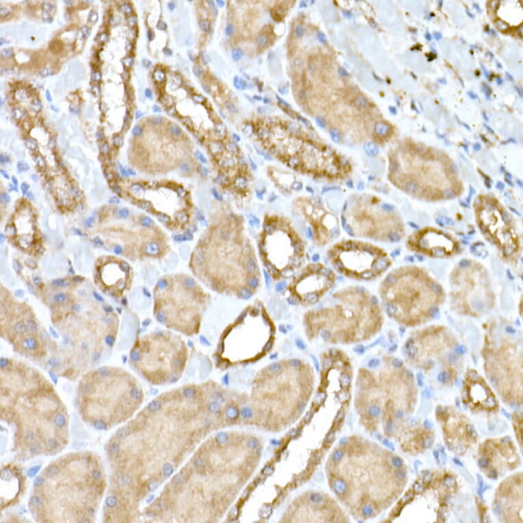 Immunohistochemistry - Anti-NPHP1 Antibody (A15326) - Antibodies.com