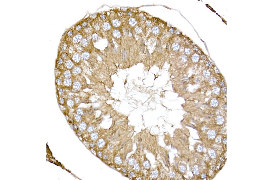Immunohistochemistry - Anti-NPHP1 Antibody (A15326) - Antibodies.com