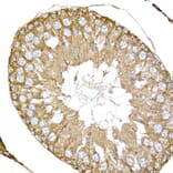 Immunohistochemistry - Anti-NPHP1 Antibody (A15326) - Antibodies.com