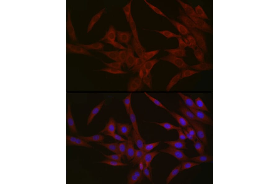 Immunofluorescence - Anti-NPHP1 Antibody (A15326) - Antibodies.com