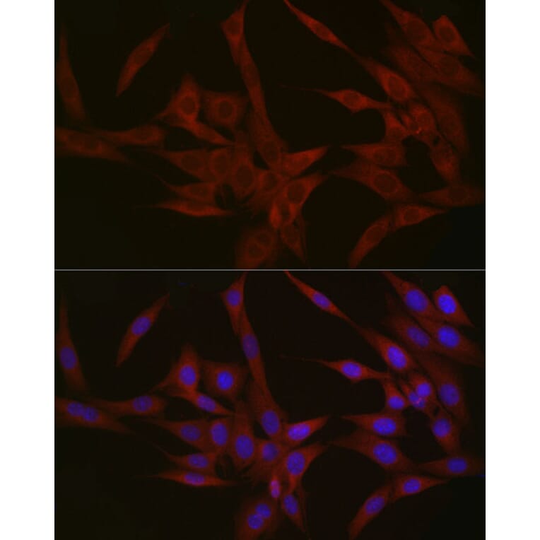 Immunofluorescence - Anti-NPHP1 Antibody (A15326) - Antibodies.com
