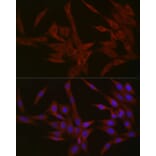 Immunofluorescence - Anti-NPHP1 Antibody (A15326) - Antibodies.com