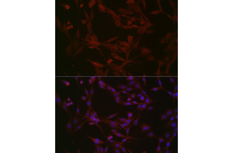 Immunofluorescence - Anti-NPHP1 Antibody (A15326) - Antibodies.com