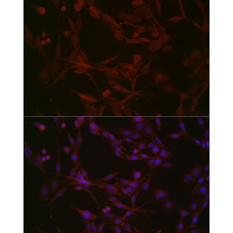 Immunofluorescence - Anti-NPHP1 Antibody (A15326) - Antibodies.com