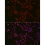 Immunofluorescence - Anti-NPHP1 Antibody (A15326) - Antibodies.com