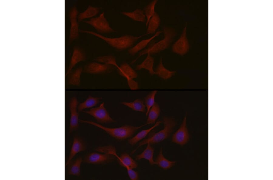 Immunofluorescence - Anti-NPHP1 Antibody (A15326) - Antibodies.com
