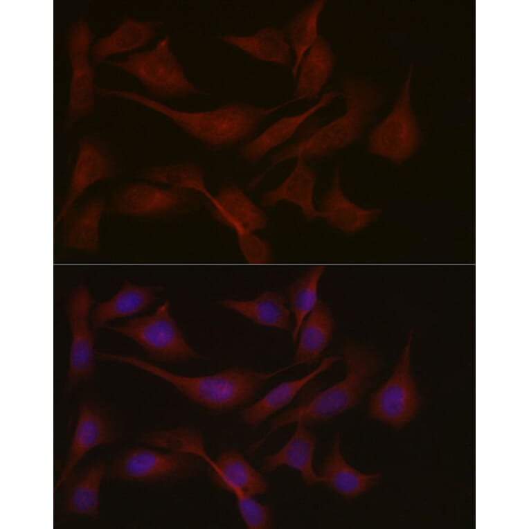 Immunofluorescence - Anti-NPHP1 Antibody (A15326) - Antibodies.com