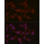 Immunofluorescence - Anti-NPHP1 Antibody (A15326) - Antibodies.com