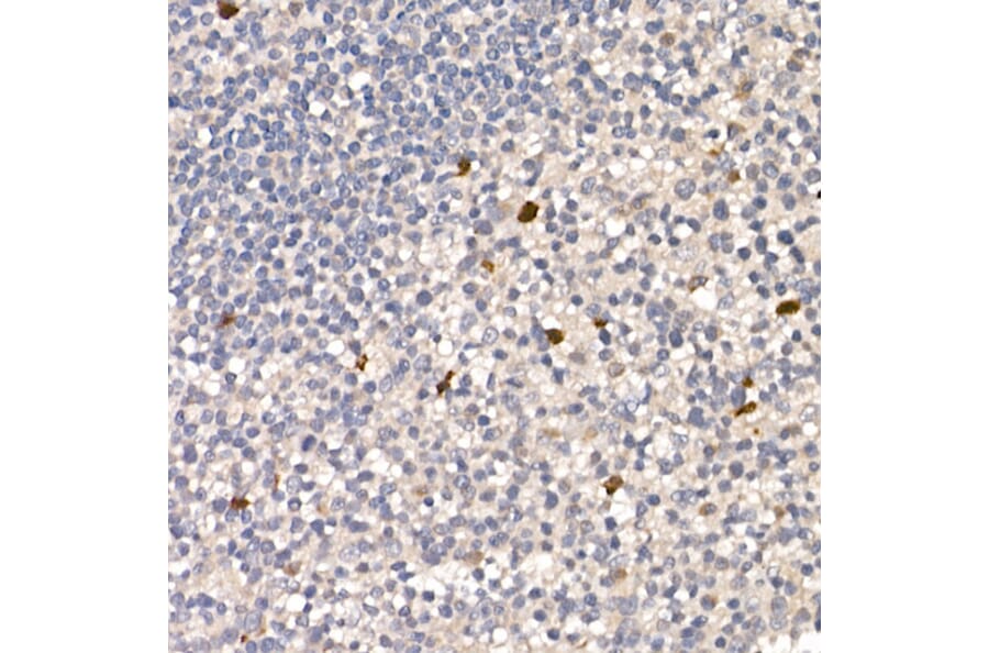 Immunohistochemistry - Anti-NUR77 Antibody (A15327) - Antibodies.com