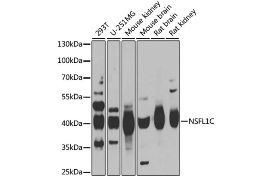 Western Blot - Anti-NSFL1C Antibody (A15328) - Antibodies.com