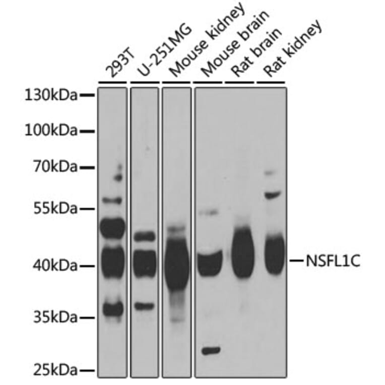Western Blot - Anti-NSFL1C Antibody (A15328) - Antibodies.com