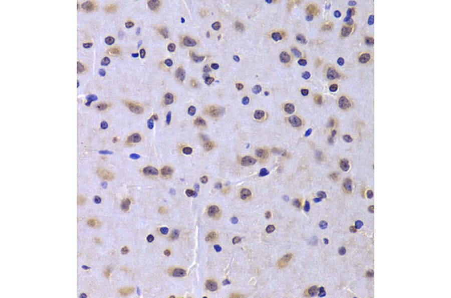 Immunohistochemistry - Anti-NUDC Antibody (A6678) - Antibodies.com