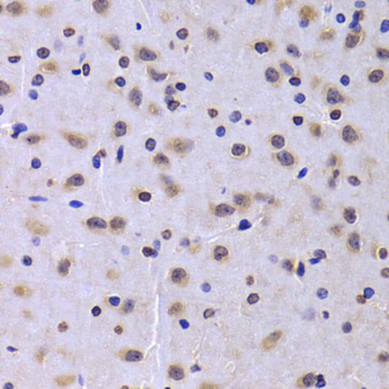 Immunohistochemistry - Anti-NUDC Antibody (A6678) - Antibodies.com