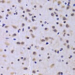 Immunohistochemistry - Anti-NUDC Antibody (A6678) - Antibodies.com