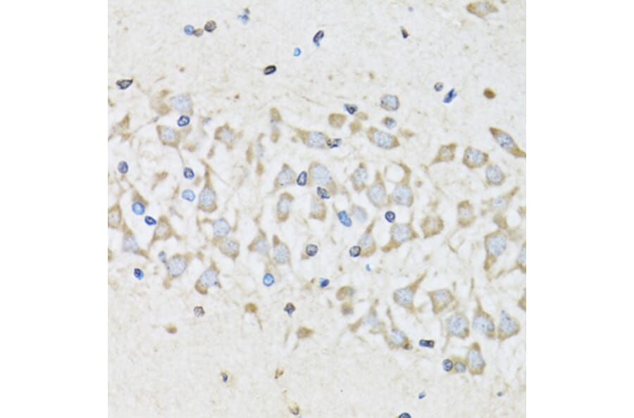 Immunohistochemistry - Anti-NUDC Antibody (A6678) - Antibodies.com
