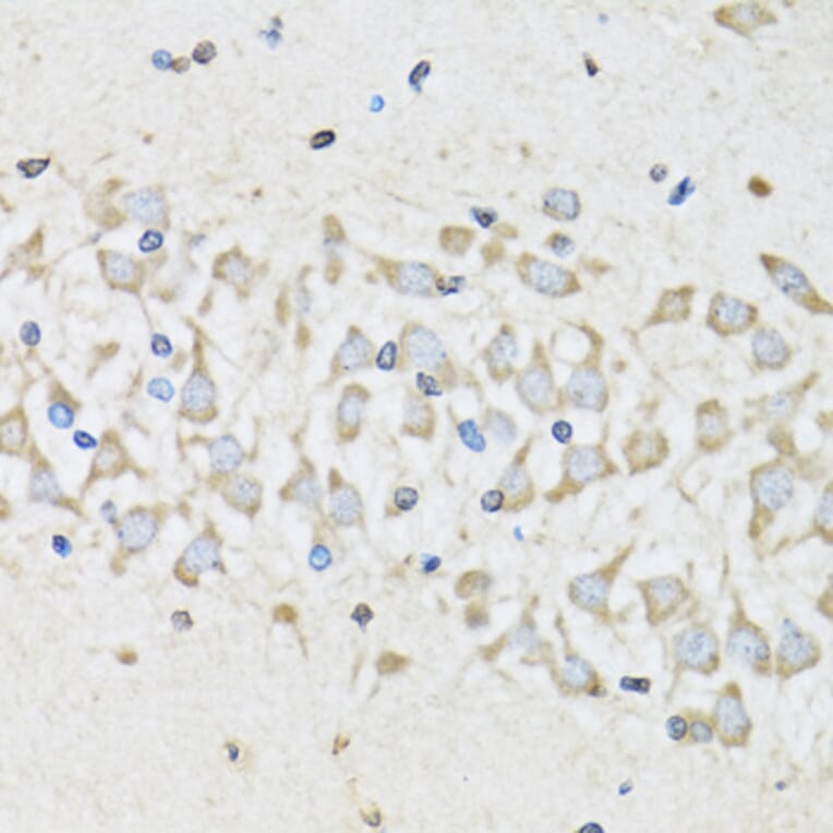 Immunohistochemistry - Anti-NUDC Antibody (A6678) - Antibodies.com
