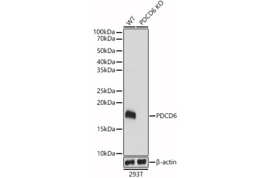 Western Blot - Anti-PDCD6/ALG-2 Antibody (A15330) - Antibodies.com