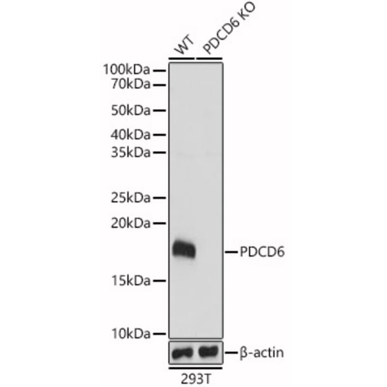 Western Blot - Anti-PDCD6/ALG-2 Antibody (A15330) - Antibodies.com