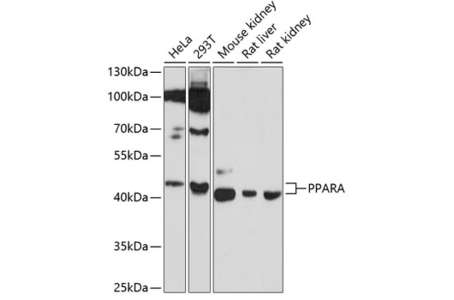 Western Blot - Anti-PPARA Antibody (A6697) - Antibodies.com