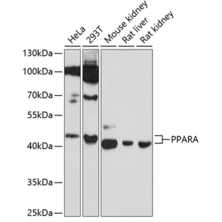 Western Blot - Anti-PPARA Antibody (A6697) - Antibodies.com