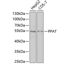 Western Blot - Anti-Phosphoribosyl pyrophosphate amidotransferase Antibody (A15332) - Antibodies.com