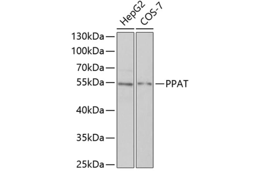 Western Blot - Anti-Phosphoribosyl pyrophosphate amidotransferase Antibody (A15332) - Antibodies.com
