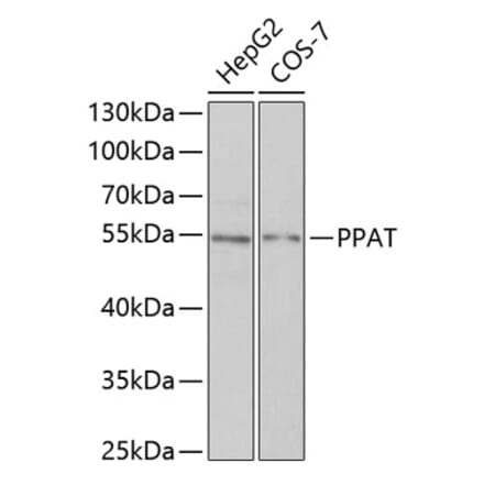 Western Blot - Anti-Phosphoribosyl pyrophosphate amidotransferase Antibody (A15332) - Antibodies.com