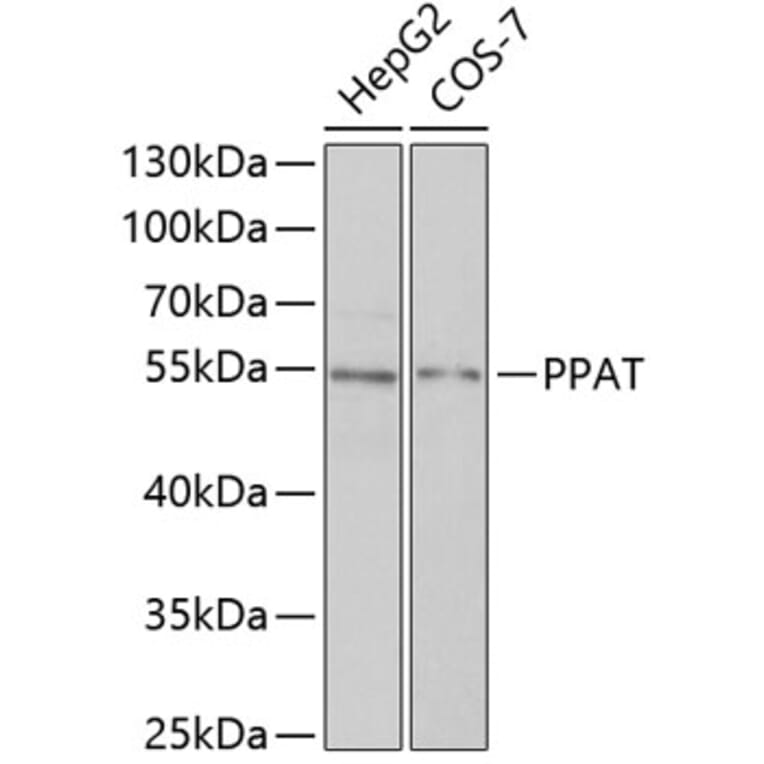 Western Blot - Anti-Phosphoribosyl pyrophosphate amidotransferase Antibody (A15332) - Antibodies.com