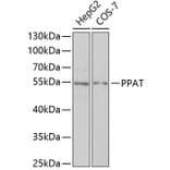Western Blot - Anti-Phosphoribosyl pyrophosphate amidotransferase Antibody (A15332) - Antibodies.com