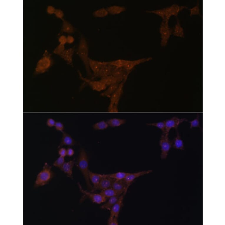 Immunofluorescence - Anti-Phosphoribosyl pyrophosphate amidotransferase Antibody (A15332) - Antibodies.com
