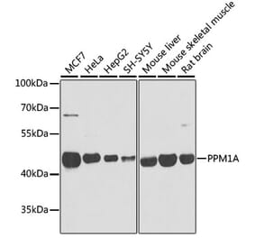 Western Blot - Anti-PPM1A Antibody (A15333) - Antibodies.com