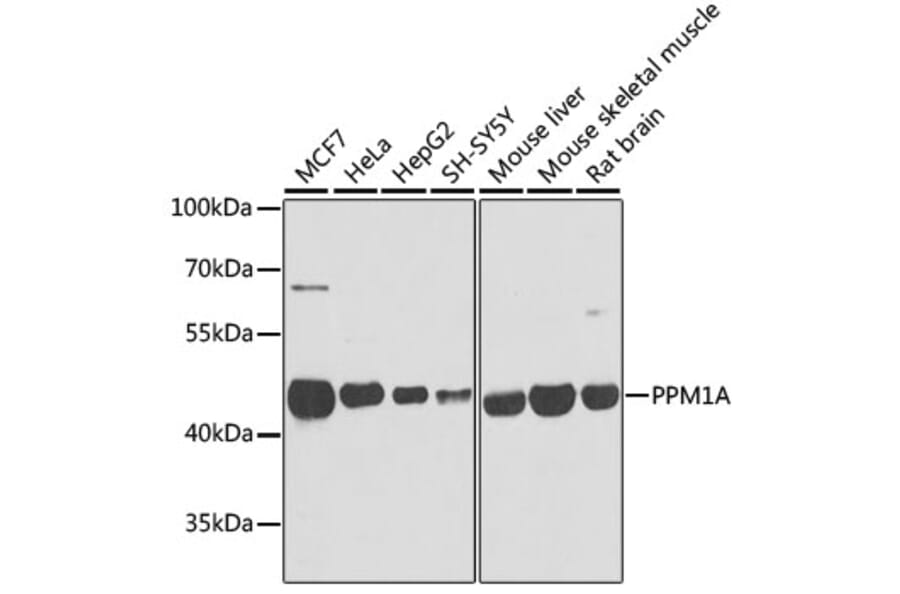 Western Blot - Anti-PPM1A Antibody (A15333) - Antibodies.com